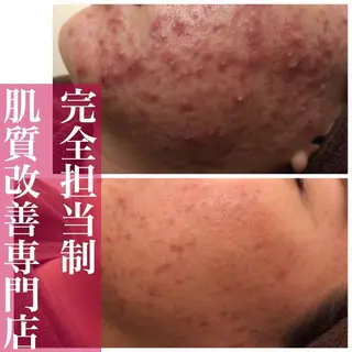 ミディアム カラー パーマ ヘアアレンジ メンズ キッズ ネイル マツエク・マツパ アイブロウ ニキビ・肌質改善専門 ♡人生が変わるサロンのエステ・リラクイメージ