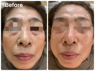 NICORI所属・NICORI大宮 (看護師)塩野飛のエステ・リラクイメージ