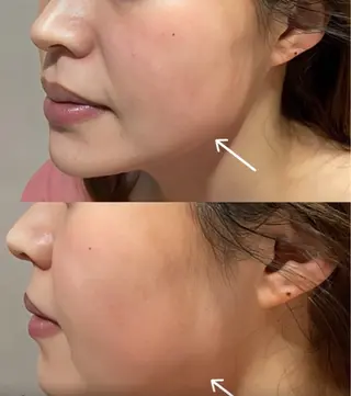 マツエク・マツパ 愛維美水光美肌専門店所属・愛維美水光美肌専門店 メンズレディースokのエステ・リラクイメージ