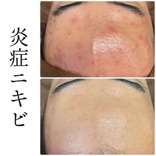 ハーブピーリング専門 BIOEL横浜のエステ・リラクイメージ