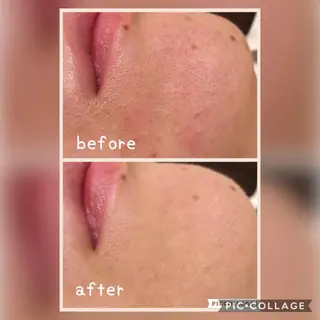 美肌蘇生カウンセラー 横山りえのエステ・リラクイメージ