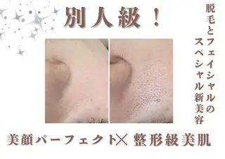 創業40周年✨美肌サ ロンRAYVIS銀座のエステ・リラクイメージ