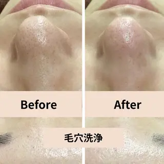 【小顔・毛穴ケア】 セラピスト 和田紋子のエステ・リラクイメージ