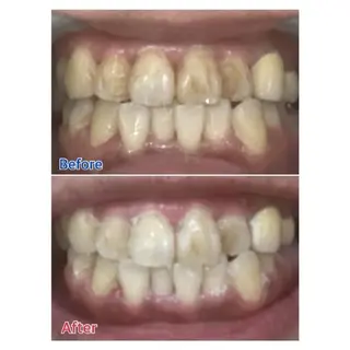 M渋谷店所属・M渋谷 ホワイトニングのエステ・リラクイメージ