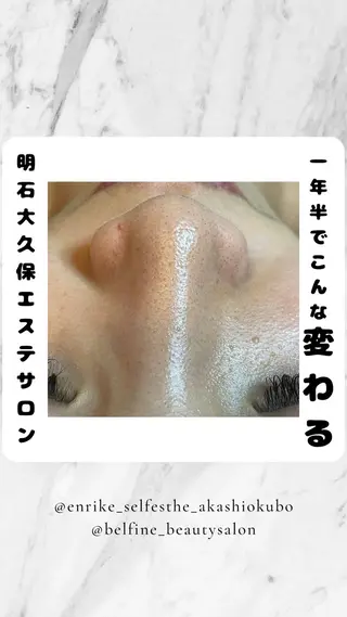 セルフエステエンリケ明石大久保店所属・夕希リンパ&痩身& 脱毛&毛穴ケアのエステ・リラクイメージ