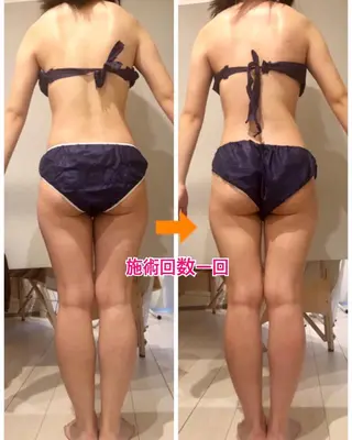 ショート カラー パーマ ヘアアレンジ メンズ キッズ ネイル マツエク・マツパ ‍痩身＆ボディ 結果出し🌟丹野のエステ・リラクイメージ