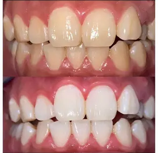 プラチナムビューティー柏所属・【歯科提携】柏ホワイ トニングスタイルのその他イメージ