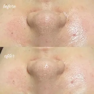 merveilles所属・まつげ/整体/にきび ・アトピー専門サロンのマツエク・マツパデザイン