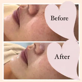 ニキビ/敏感肌/乾燥 Lilyauraのエステ・リラクイメージ
