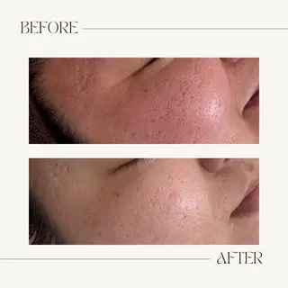 CEsalonEgg 齋藤のエステ・リラクイメージ