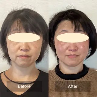 ルコナビューティ所属・小顔・歪み専門　井元 朋子のエステ・リラクイメージ