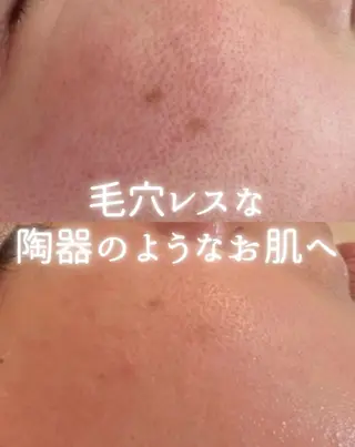 private beauty salon Lilby所属・リルビー 肌育・肌質改善サロンのその他イメージ