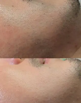 メンズ 姫路御立脱毛サロンSClass.所属・姫路御立脱毛サロン S Class.のエステ・リラクイメージ