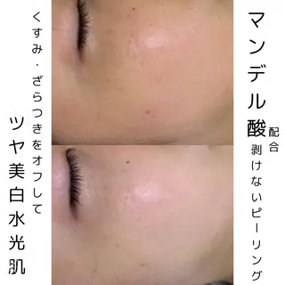 メンズ 歌舞伎町深夜サロン to mëのエステ・リラクイメージ