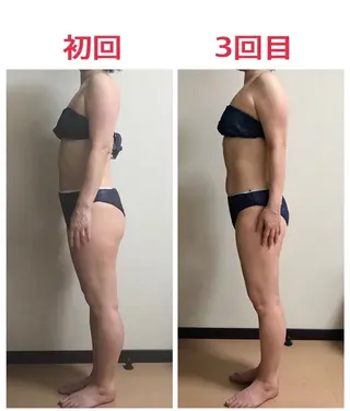 バストアップ・痩身 脱毛/🌺ｺｵﾘﾅのエステ・リラクイメージ