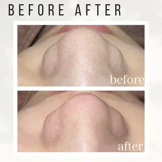 Beauty salon ハピー所属・大人女性のための 肌管理サロン　ハピーのエステ・リラクイメージ