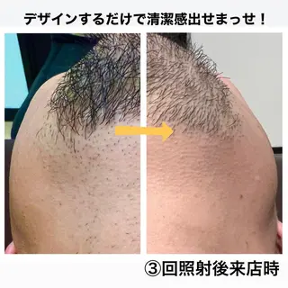 メンズ メンズ脱毛サロン Le falcoのエステ・リラクイメージ