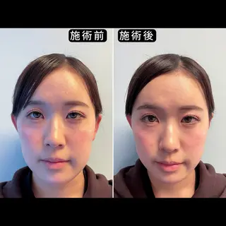 渋谷 小顔美容鍼 専門サロン YZのエステ・リラクイメージ