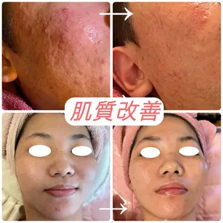 フェイシャルサロン クリスタのエステ・リラクイメージ