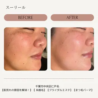 肌荒れに悩む方のため オイルフリーサロンのマツエク・マツパデザイン