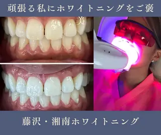 ネイル glitter.SHONAN所属・ホワイトニング専門店 glitterのその他イメージ