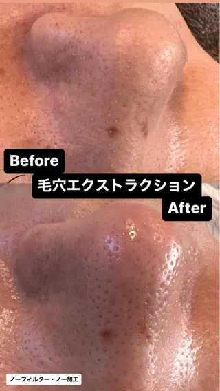 Ummi所属・肌管理／眉毛．まつ毛 陽子の眉毛・アイブロウイメージ