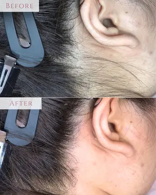 肌質改善専門サロン Bellmi/心斎橋のエステ・リラクイメージ