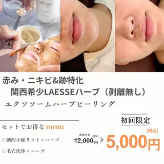 小顔・肌質改善 espoir 心斎橋のエステ・リラクイメージ