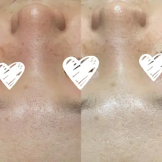 肌質体質改善サロン 🌿ミュリール橋本店のエステ・リラクイメージ