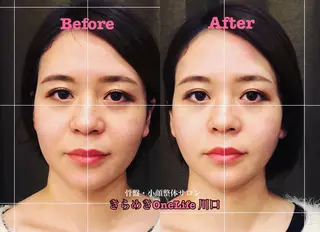 きらめきワンライフ Yumaのエステ・リラクイメージ