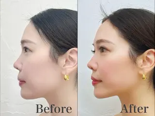 Prendre karinの眉毛・アイブロウイメージ