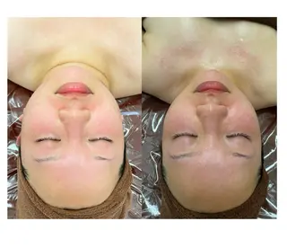 espresso,所属・《痩身、小顔専門店》 エスプレッソのエステ・リラクイメージ