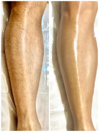 メンズ CHICIEL所属・枚方市香里園脱毛 サロンCHICIELのエステ・リラクイメージ