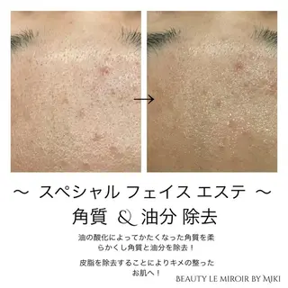 ビューティー ミロワールのエステ・リラクイメージ