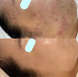 【新宿】 PulBeauteのエステ・リラクイメージ