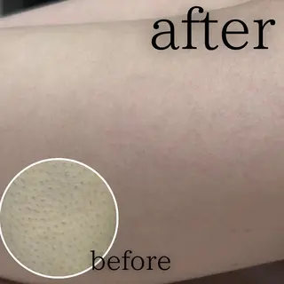 美肌脱毛&毛穴専門 Nico🐰ྀི♡のエステ・リラクイメージ