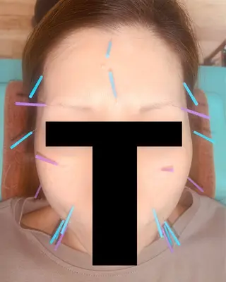 河輪 鍼灸接骨院のエステ・リラクイメージ