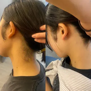 うなじ脱毛/美肌脱毛 LABELのエステ・リラクイメージ