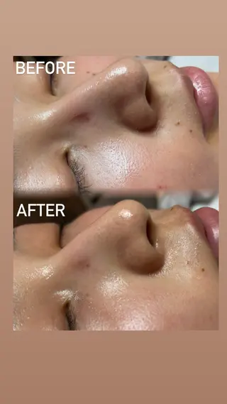 Minnat所属・元田 純静のエステ・リラクイメージ