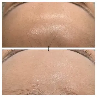 ビューティー ミロワールのエステ・リラクイメージ