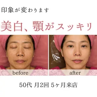 オアシス・さくら所属・自然美人を叶える小顔 と脱毛サロンのエステ・リラクイメージ