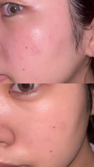 HARIMIN所属・山野 萌々香のエステ・リラクイメージ