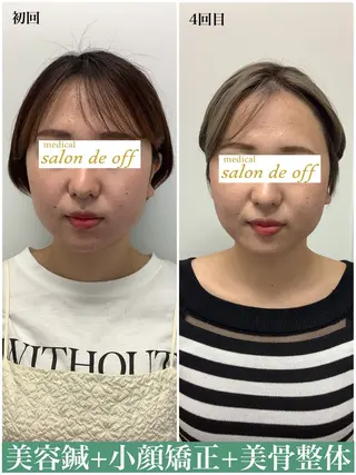 メディカルサロンドオフ所属・ハリサロンドオフ 美容鍼灸×小顔整体のエステ・リラクイメージ