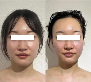 MOREB'S所属・MOREB'S サラのエステ・リラクイメージ