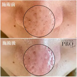 毛穴専門店アイミュー mamiのエステ・リラクイメージ