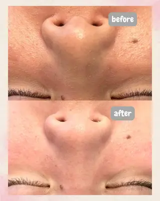 beauty salon  SUKOBI所属・ﾋﾞｭｰﾃｨｻﾛﾝ SUKOBIのエステ・リラクイメージ