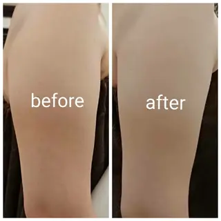 若返り 美肌   エステサロンららんのエステ・リラクイメージ