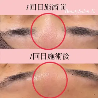 N. 鈴木翔子のエステ・リラクイメージ