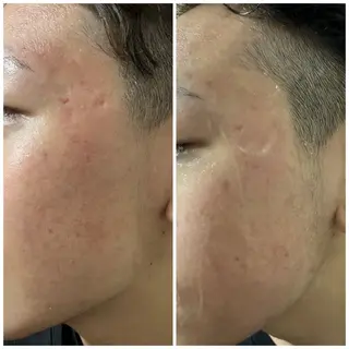 デ・アイム塚口所属・肌質/体質改善 久下玲菜のエステ・リラクイメージ