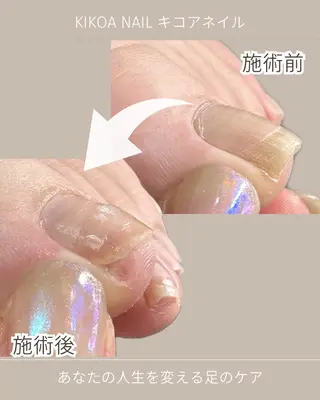 ネイル KIKOA NAIL キコアネイルのネイルデザイン